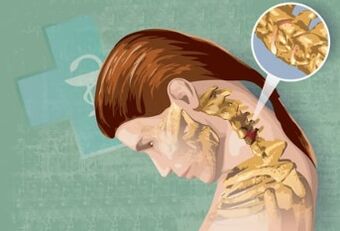 Reflex symptoms of cervical osteochondrose