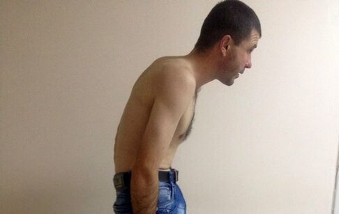 Ankylosing spondylitis can cause lower back pain for years